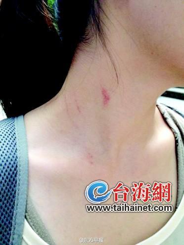 起因是攬客不成起爭執(zhí) (1)