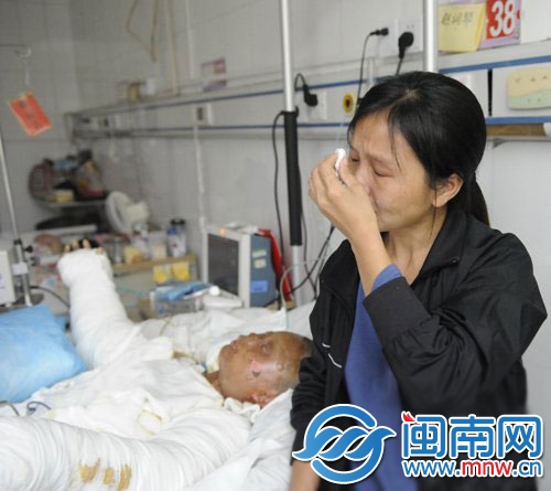 廈門一打工女因煤氣爆燃全身燒傷80%3