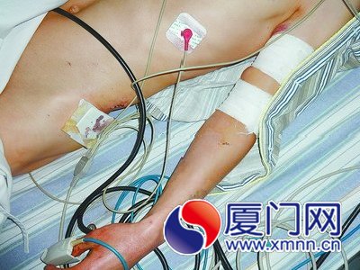 小剛被多處砍傷