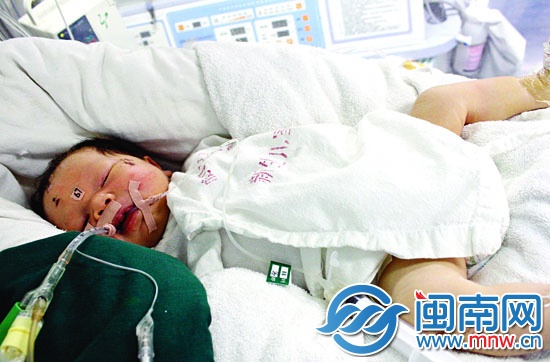 廈門奇跡寶寶趙平安病情加重
