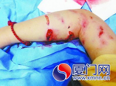 被咬得血肉模糊的小豪。